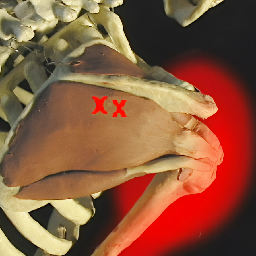 Deep Tissue & Neuromuscular Therapy